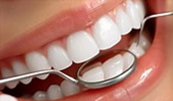 image of dental examination